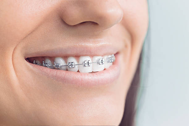 Best Dental Fillings (Composite and Amalgam)  in Stevensville, MT
